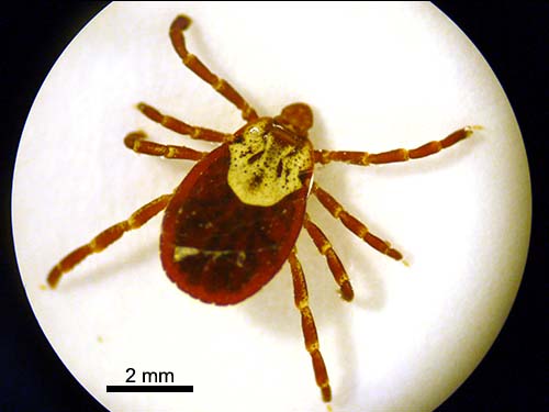 American dog tick