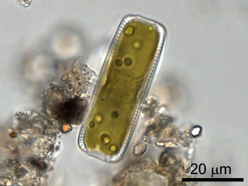 Diatom