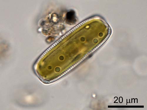 Diatom
