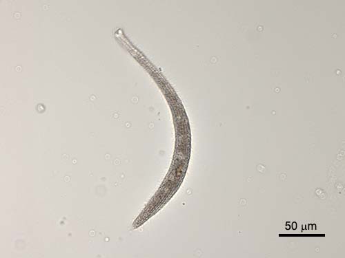 Spirostomum teres