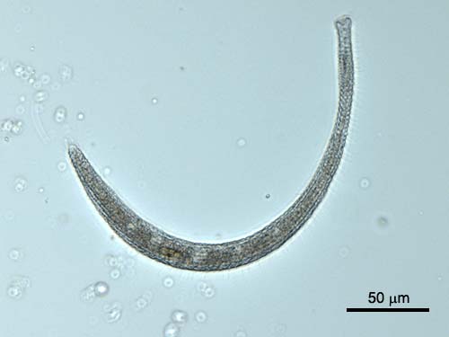 Spirostomum teres